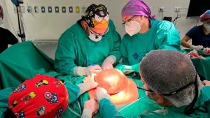 Más de 20 cirujanos y asistentes operaron durante 11 horas a un paciente para extirparle un tumor de 4,2 kilos