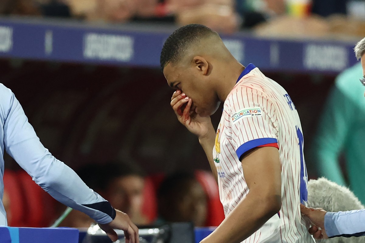 Aseguran que Mbappé ya se encuentra mejor de su lesión